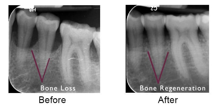 Dental x-rays